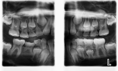 California Dental Home